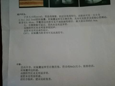journal_insert_pic_854007966