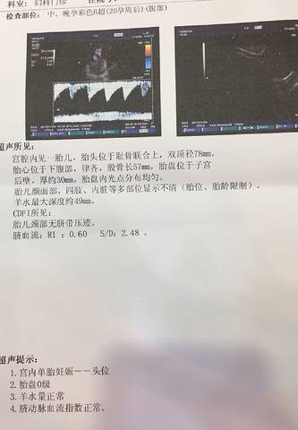 journal_insert_pic_854282832