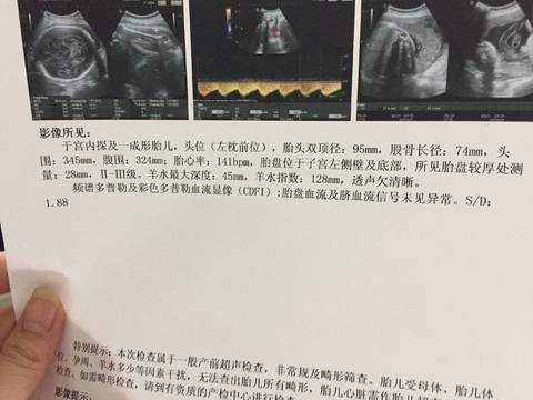 journal_insert_pic_855585921