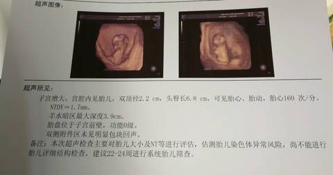 13周胎儿大小标准图片图片