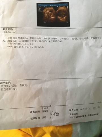 journal_insert_pic_861724569