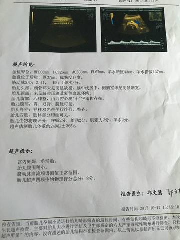 37周4胎位臀围 还偏瘦小咋办 宝宝树