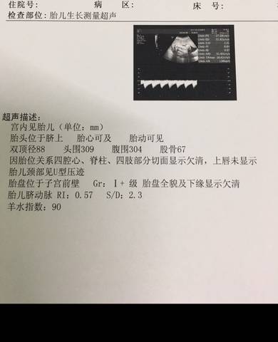 journal_insert_pic_865301470