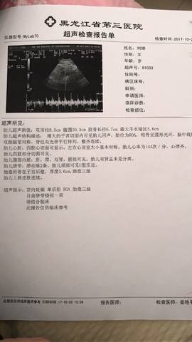 journal_insert_pic_866170056