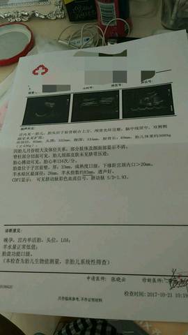 journal_insert_pic_868096760