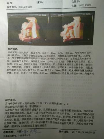 journal_insert_pic_869455867