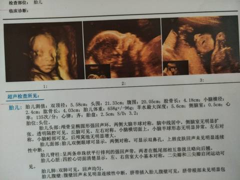 journal_insert_pic_870773040
