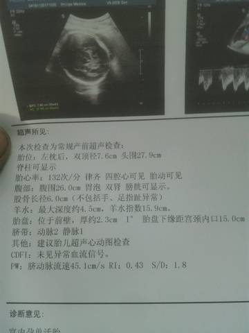 journal_insert_pic_873207400