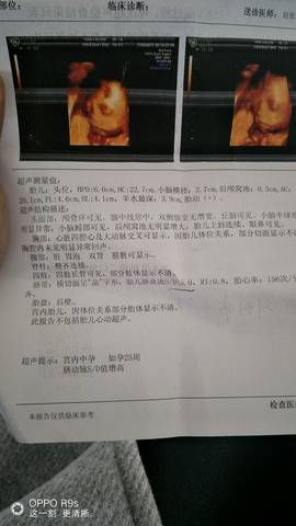 journal_insert_pic_876016382
