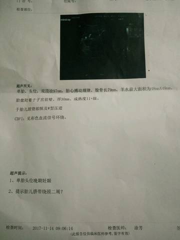 journal_insert_pic_884917347