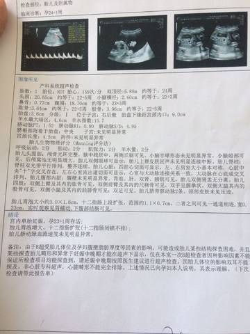 journal_insert_pic_885880909