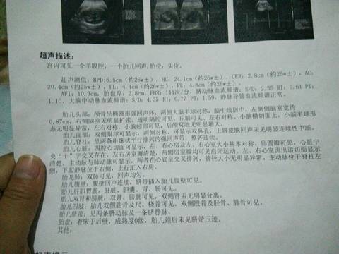 journal_insert_pic_887725883