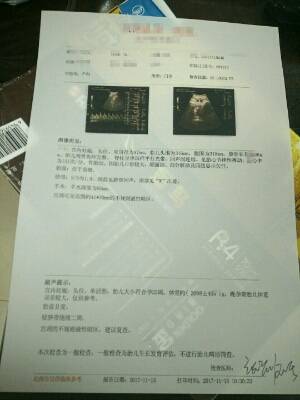 journal_insert_pic_888720403