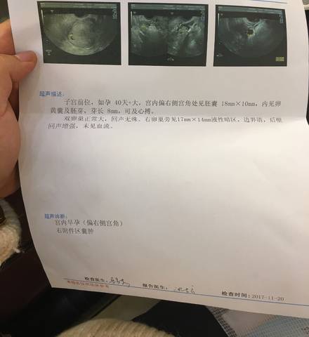 journal_insert_pic_889082240