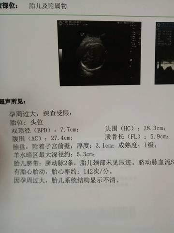 journal_insert_pic_892050019
