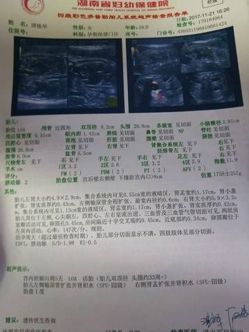 journal_insert_pic_892431432