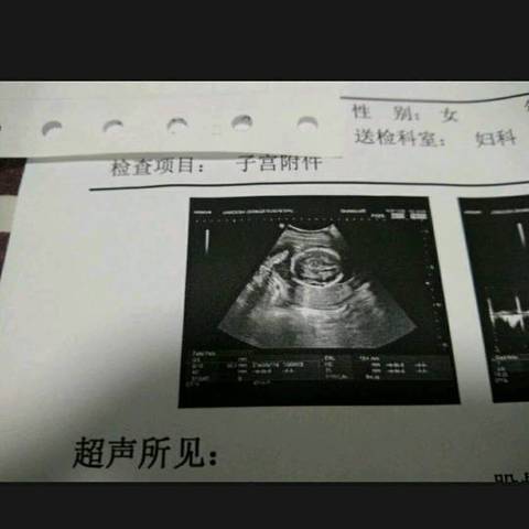 journal_insert_pic_896537262