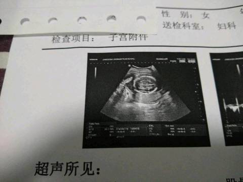 journal_insert_pic_896537268