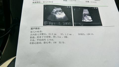 journal_insert_pic_903143689