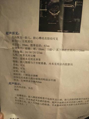 journal_insert_pic_905053052