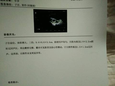 journal_insert_pic_905054603