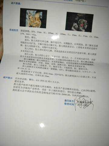 journal_insert_pic_910509579