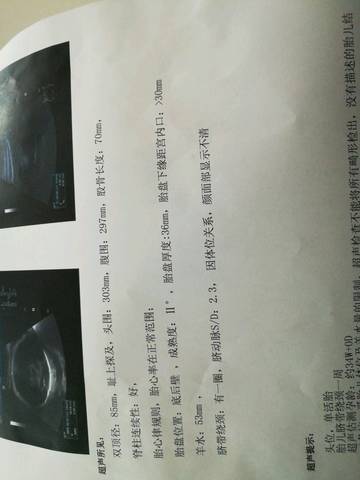 journal_insert_pic_910095128