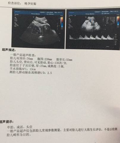 journal_insert_pic_911557617