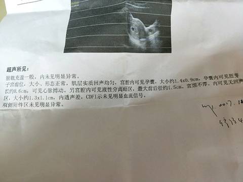 journal_insert_pic_911814312