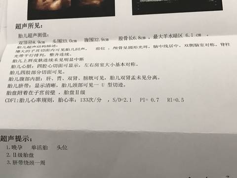 journal_insert_pic_912359093