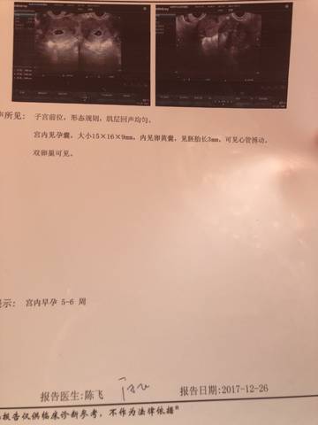 journal_insert_pic_912962848