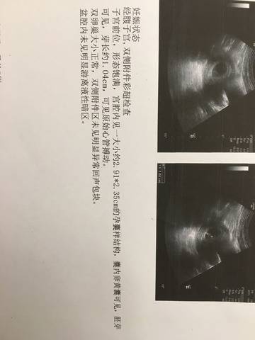journal_insert_pic_912997861