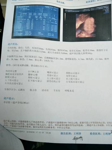 journal_insert_pic_913603326