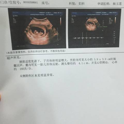 journal_insert_pic_914659514
