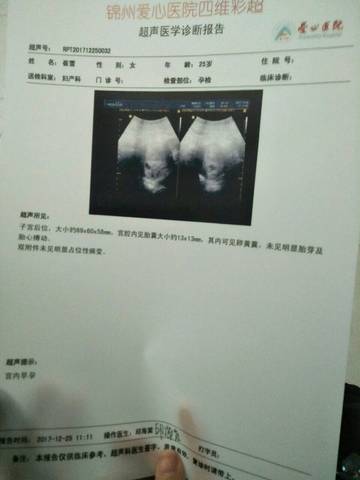 journal_insert_pic_914658824