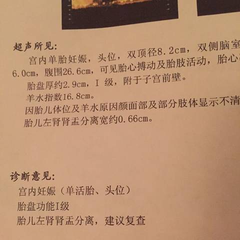 journal_insert_pic_915356971