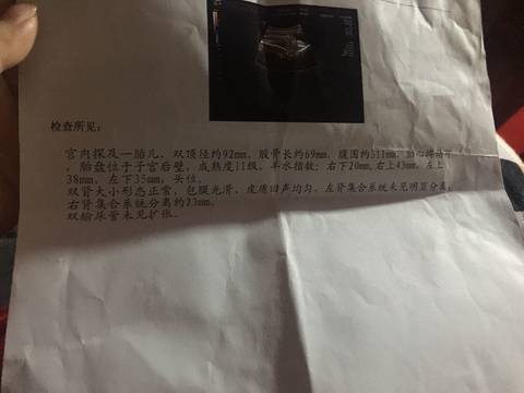 journal_insert_pic_918708411