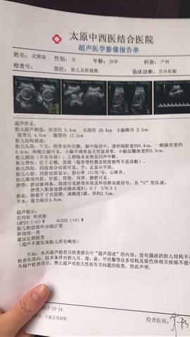 journal_insert_pic_920542857