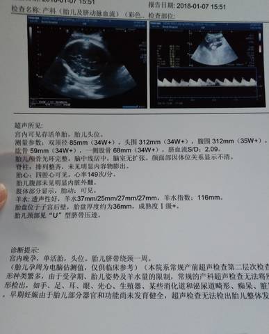 journal_insert_pic_920924447