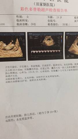 journal_insert_pic_921495406