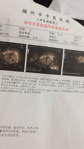 journal_insert_pic_921495404