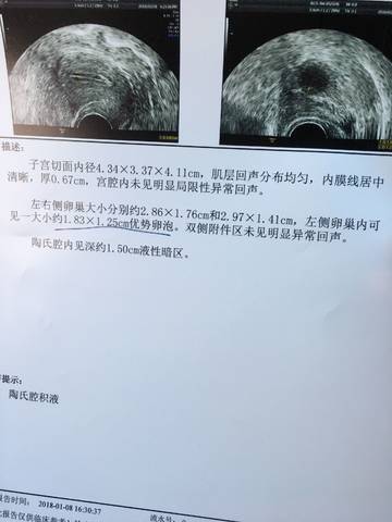 journal_insert_pic_921664949