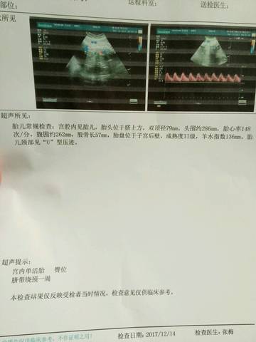 journal_insert_pic_922070795