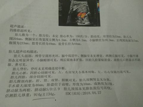 journal_insert_pic_922844157
