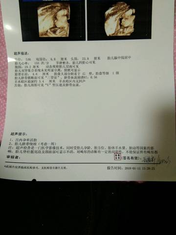 journal_insert_pic_923725293