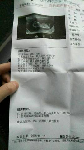 journal_insert_pic_924420006