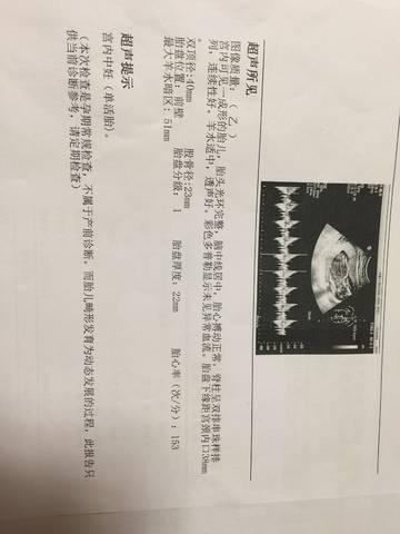 journal_insert_pic_926782008
