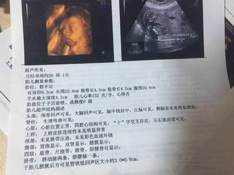 journal_insert_pic_926402771