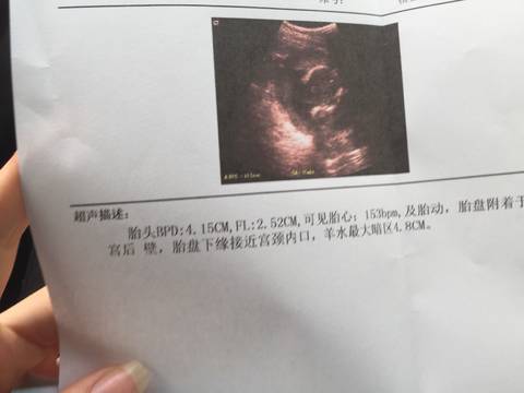 journal_insert_pic_927044344
