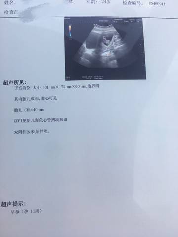 journal_insert_pic_928038324